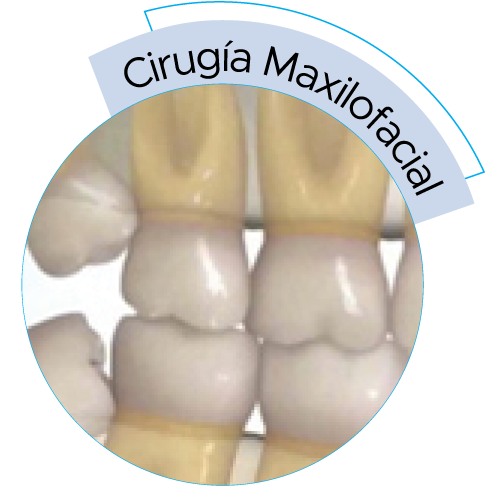 dental-solutions-cirugia-maxilofacial