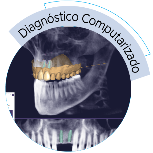 dental-solutions-diagnostico-computarizado