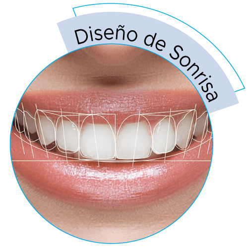 dental-solutions-diseño-sonrisas