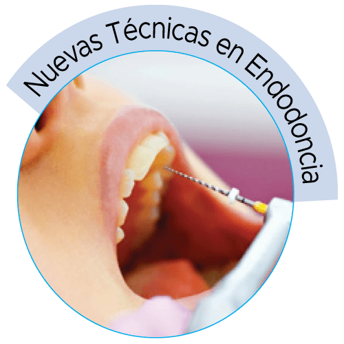 dental-solutions-odontologia-nuevas-tecnicas-endodoncia
