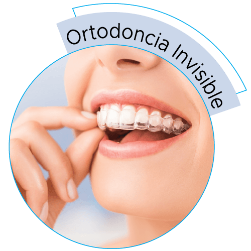 dental-solutions-ortodoncia-invisible