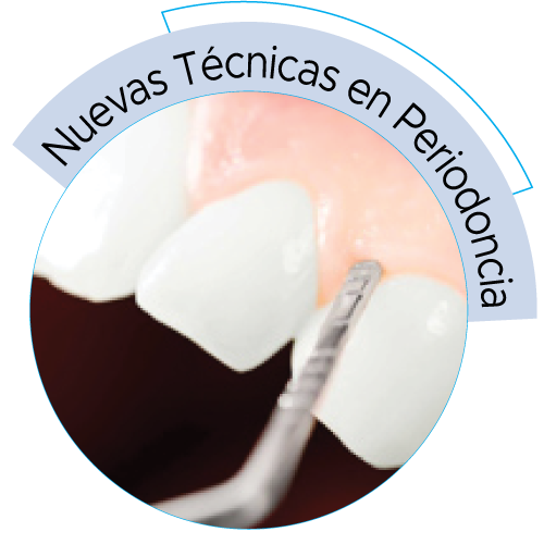 dental-solutions-periodoncia