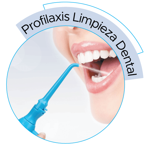 dental-solutions-profilaxis-limpieza-dental